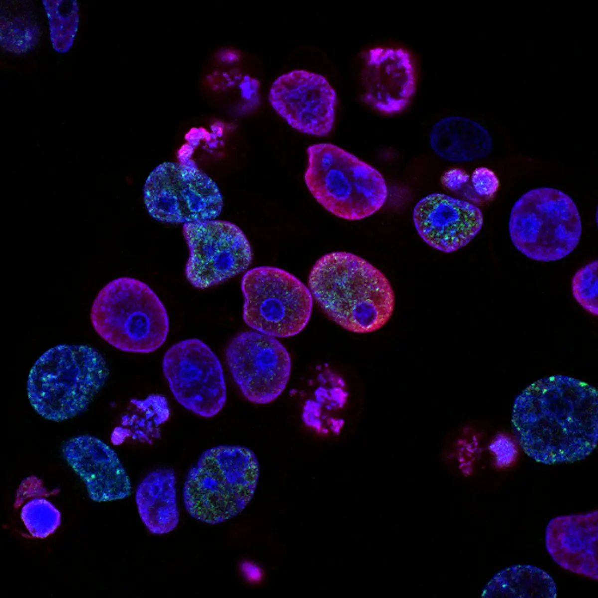 Apoptosis, Necrosis, and NETosis: The Three Engines of Cell-Free DNA
